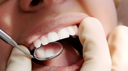 featuredProgram_dental